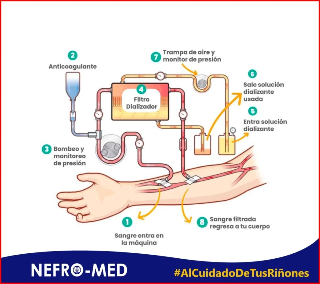 Máquina de Hemodiálisis
